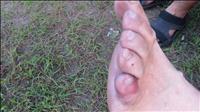 thumbnail of Injuries