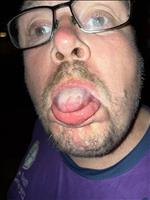 thumbnail of 